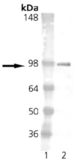 Anti-Estrogen Receptor alpha antibody [h-151] used in Western Blot (WB). GTX13538