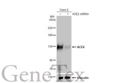 Anti-ACE2 antibody used in Western Blot (WB). GTX135403