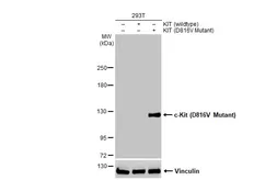 Anti-c-Kit (D816V Mutant) antibody used in Western Blot (WB). GTX135431