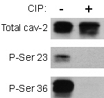 Anti-Caveolin 2 (phospho Ser36) antibody used in Western Blot (WB). GTX13544