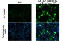 Anti-SARS-CoV-2 (COVID-19) nsp12 antibody used in Immunocytochemistry/ Immunofluorescence (ICC/IF). GTX135467