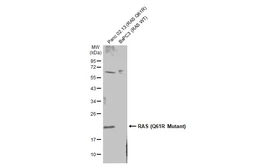 Anti-RAS (Q61R Mutant) antibody used in Western Blot (WB). GTX135497