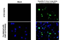 Anti-Hepatitis D virus Large delta protein antibody used in IHC-P (cell pellet) (IHC-P (cell pellet)). GTX135574