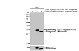 Anti-Hepatitis D virus Large delta + Small delta antibody used in Western Blot (WB). GTX135575