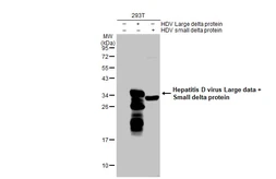 Anti-Hepatitis D virus Large delta + Small delta protein antibody used in Western Blot (WB). GTX135576