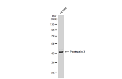 Anti-Pentraxin 3 antibody used in Western Blot (WB). GTX135596