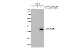 Anti-DC-SIGN antibody used in Western Blot (WB). GTX135602