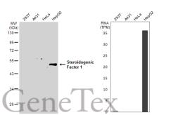 Anti-Steroidogenic Factor 1 antibody used in Western Blot (WB). GTX135635