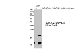 Anti-SARS-CoV-2 (COVID-19) 3CLpro (nsp5) antibody used in Western Blot (WB). GTX135648