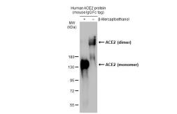 Human ACE2 (ECD) protein, mouse IgG Fc tag (active). GTX135683-pro