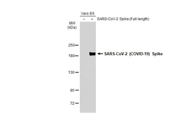 Anti-SARS-CoV-2 (COVID-19) Spike RBD antibody used in Western Blot (WB). GTX135709