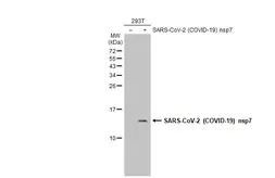 Anti-SARS-CoV-2 (COVID-19) nsp7 antibody used in Western Blot (WB). GTX135728