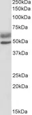Anti-AIRE (isoforms 1 and 2) antibody, C-term used in Western Blot (WB). GTX13573