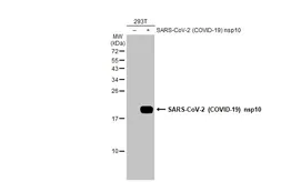 Anti-SARS-CoV-2 (COVID-19) nsp10 antibody used in Western Blot (WB). GTX135733