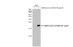 Anti-SARS-CoV-2 (COVID-19) nsp10 antibody used in Western Blot (WB). GTX135734