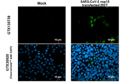Anti-SARS-CoV-2 (COVID-19) nsp15 antibody used in Immunocytochemistry/ Immunofluorescence (ICC/IF). GTX135738