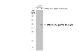Anti-SARS-CoV-2 (COVID-19) nsp16 antibody used in Western Blot (WB). GTX135739