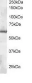 Anti-TrxR1 antibody, C-term used in Western Blot (WB). GTX13574