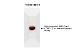 SARS-CoV-2 (COVID-19) Nucleocapsid protein, His tag (Gold). GTX135746-pro