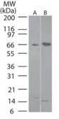 Anti-FLIP antibody used in Western Blot (WB). GTX13577