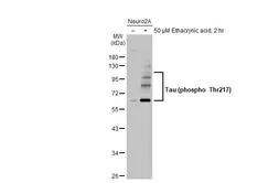 Anti-Tau (phospho Thr217) antibody used in Western Blot (WB). GTX135775