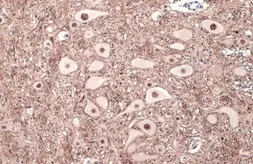 Anti-Tau (phospho Thr181) antibody used in IHC (Paraffin sections) (IHC-P). GTX135776