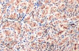 Anti-SLC17A3 antibody used in IHC (Paraffin sections) (IHC-P). GTX135781