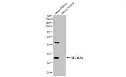 Anti-SLC17A3 antibody used in Western Blot (WB). GTX135781