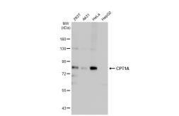 Anti-CPT1A antibody used in Western Blot (WB). GTX135785