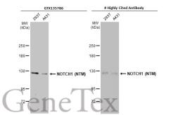 Anti-NOTCH1 antibody used in Western Blot (WB). GTX135786