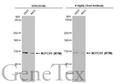 Anti-NOTCH1 antibody used in Western Blot (WB). GTX135786