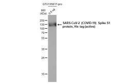 SARS-CoV-2 (COVID-19) Spike S1 protein, His tag (active). GTX135817-pro