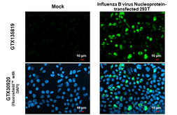 Anti-Influenza B virus Nucleoprotein antibody used in Immunocytochemistry/ Immunofluorescence (ICC/IF). GTX135819