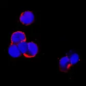 Anti-sRANKL antibody [12A668] used in Immunocytochemistry/ Immunofluorescence (ICC/IF). GTX13582