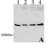 Anti-Huntingtin antibody [1A771] used in Western Blot (WB). GTX13583
