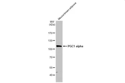 Anti-PGC1 alpha antibody used in Western Blot (WB). GTX135859
