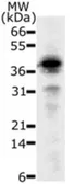 Anti-DFFB antibody [36A349] used in Western Blot (WB). GTX13592