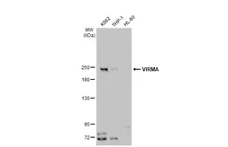 Anti-VIRMA antibody used in Western Blot (WB). GTX135924