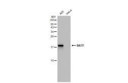 Anti-BATF antibody used in Western Blot (WB). GTX135928