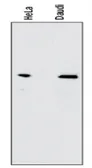 Anti-NFkB p65 antibody [112A1021] used in Western Blot (WB). GTX13594