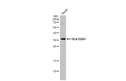 Anti-HLA-DQA1 antibody used in Western Blot (WB). GTX135986
