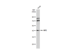 Anti-HFE antibody used in Western Blot (WB). GTX135988