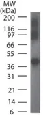 Anti-Rad9 antibody [93A535] used in Western Blot (WB). GTX13600