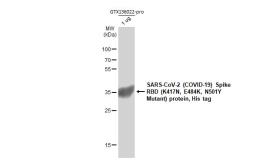 SARS-CoV-2 (COVID-19) Spike RBD Protein, B.1.351 / Beta variant, His tag (active). GTX136022-pro