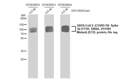 SARS-CoV-2 (COVID-19) Spike S2 (ECD) Protein, B.1.1.7 / Alpha variant, His tag. GTX136023-pro
