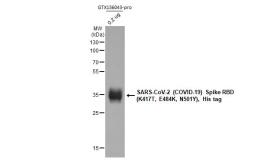 SARS-CoV-2 (COVID-19) Spike RBD Protein, P.1 / Gamma variant, His tag (active). GTX136043-pro