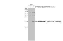 Anti-SARS-CoV-2 (COVID-19) Envelope antibody used in Western Blot (WB). GTX136046