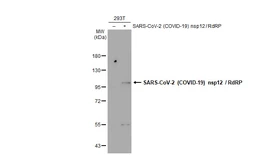 Anti-SARS-CoV-2 (COVID-19) nsp12 / RdRP antibody used in Western Blot (WB). GTX136049