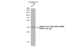 SARS-CoV-2 (COVID-19) Spike RBD Protein, B.1.1.7 with E484K, His tag (active). GTX136058-pro