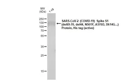SARS-CoV-2 (COVID-19) Spike S1 Protein, B.1.1.7 / Alpha variant, His tag (active). GTX136085-pro